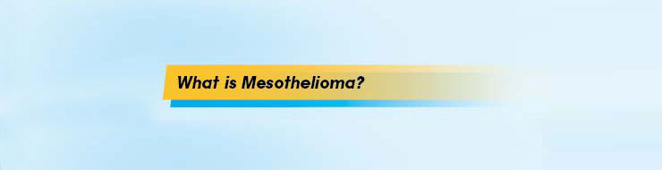 Patients_Road_Map_What_is_Mesothelioma_740